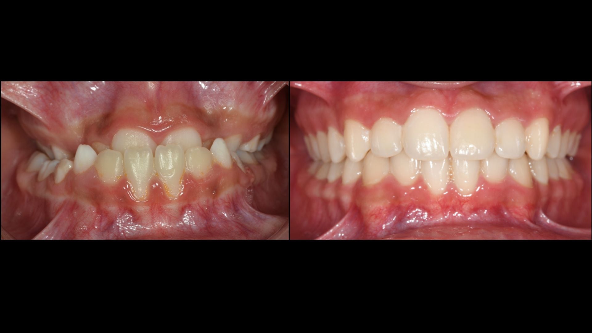 konstantinos lasposorthodontics (4)