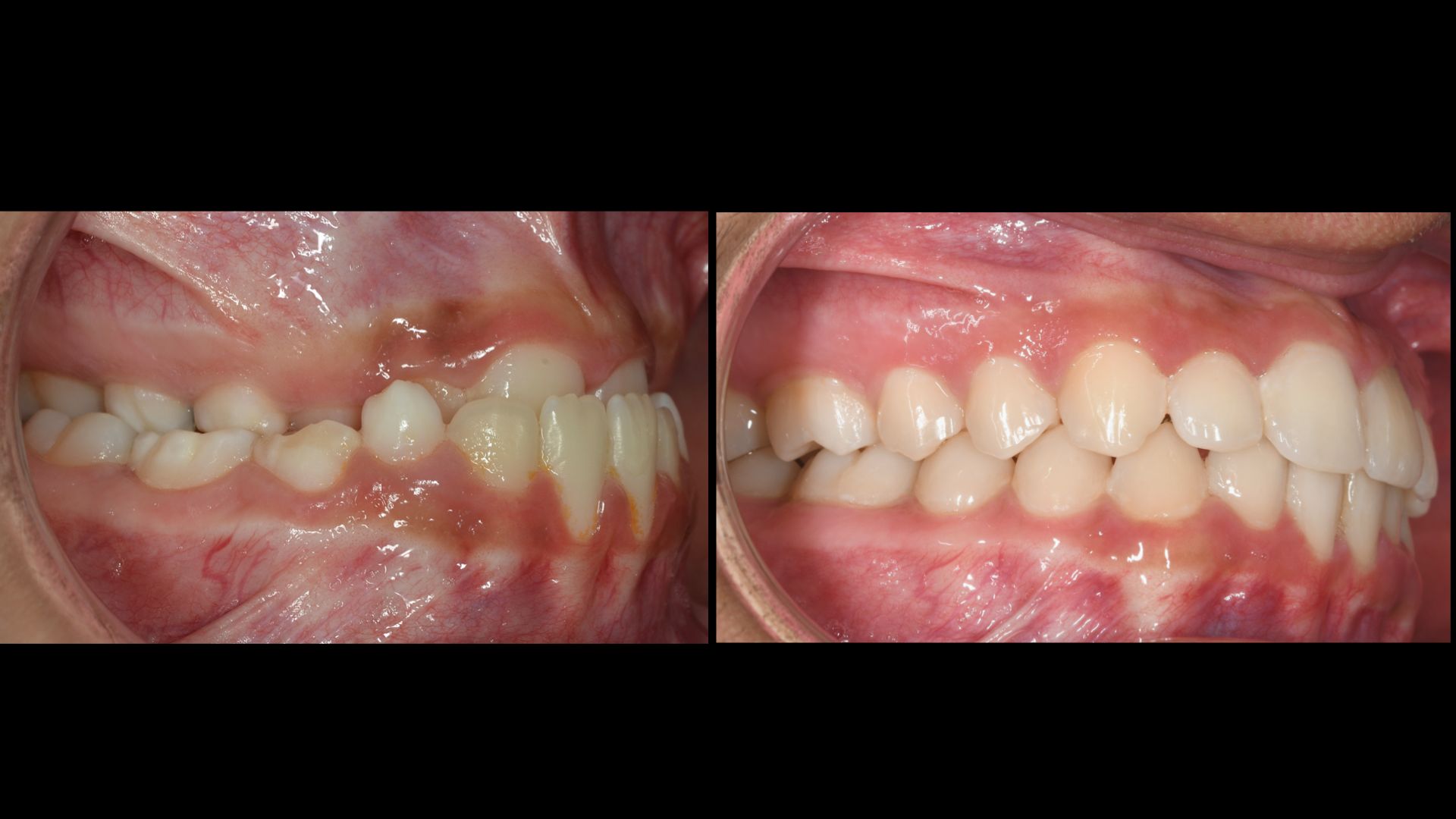 konstantinos lasposorthodontics (5)