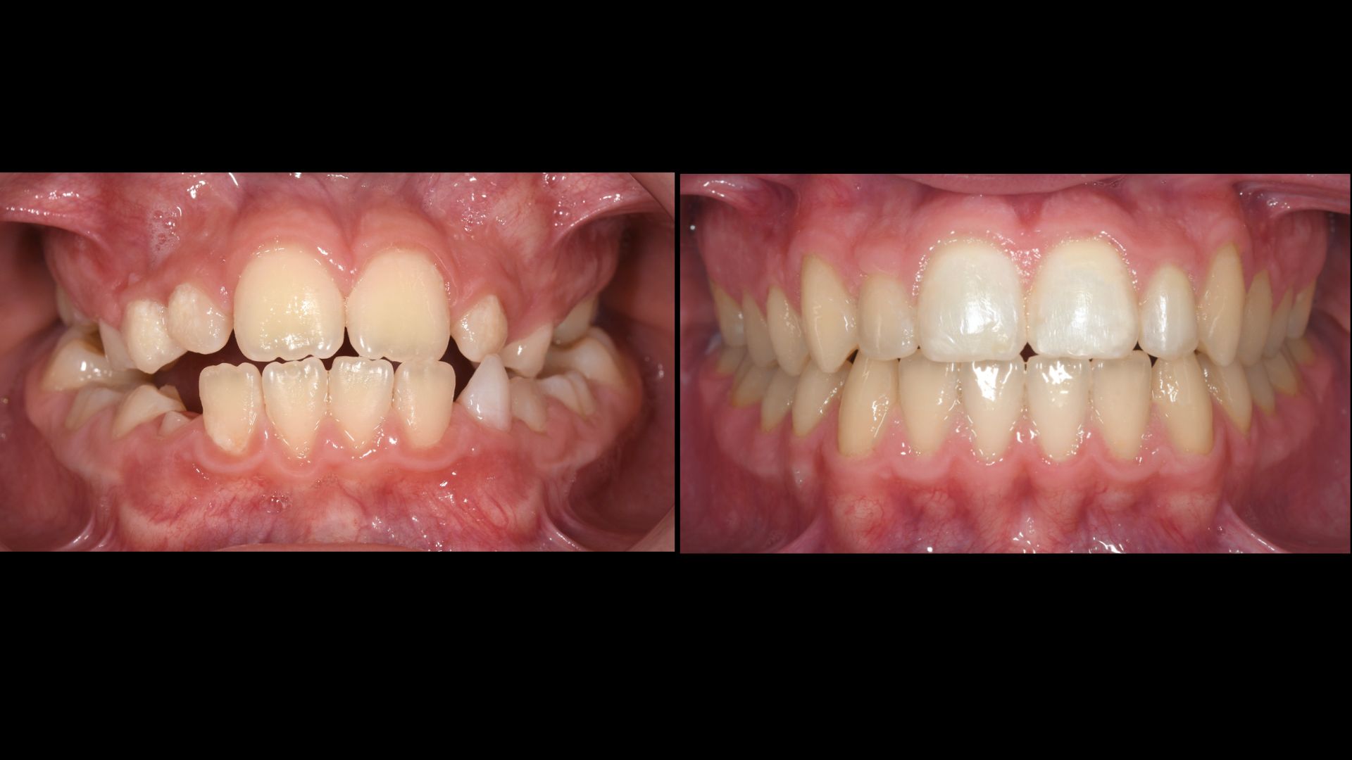 marios orthodontics (4)