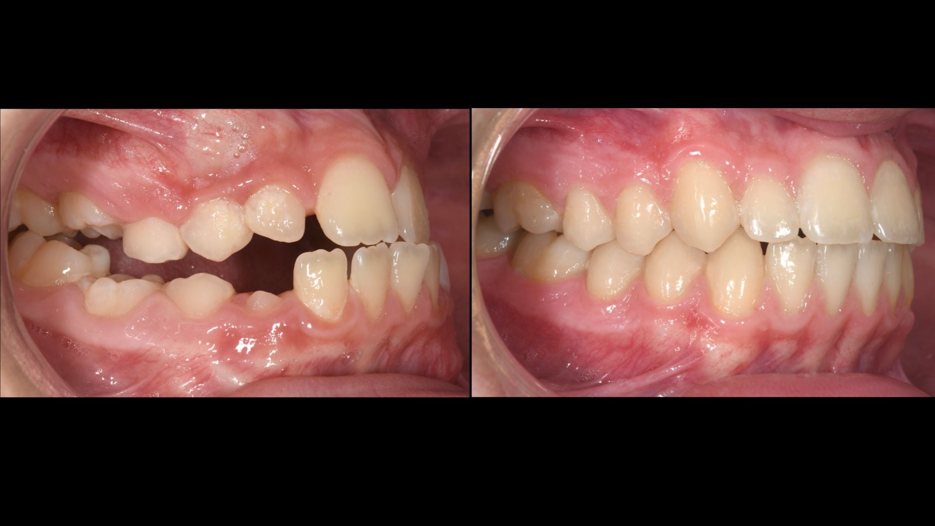 marios orthodontics (5)