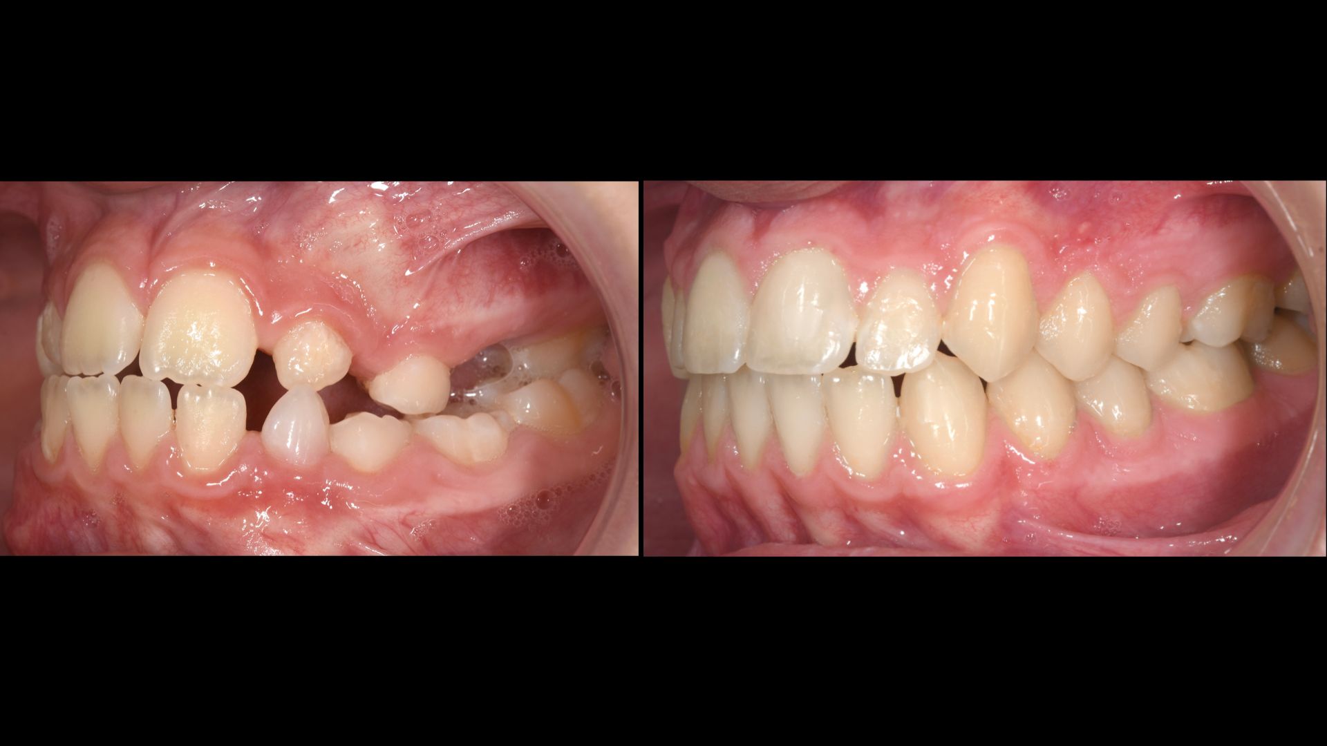 marios orthodontics (6)