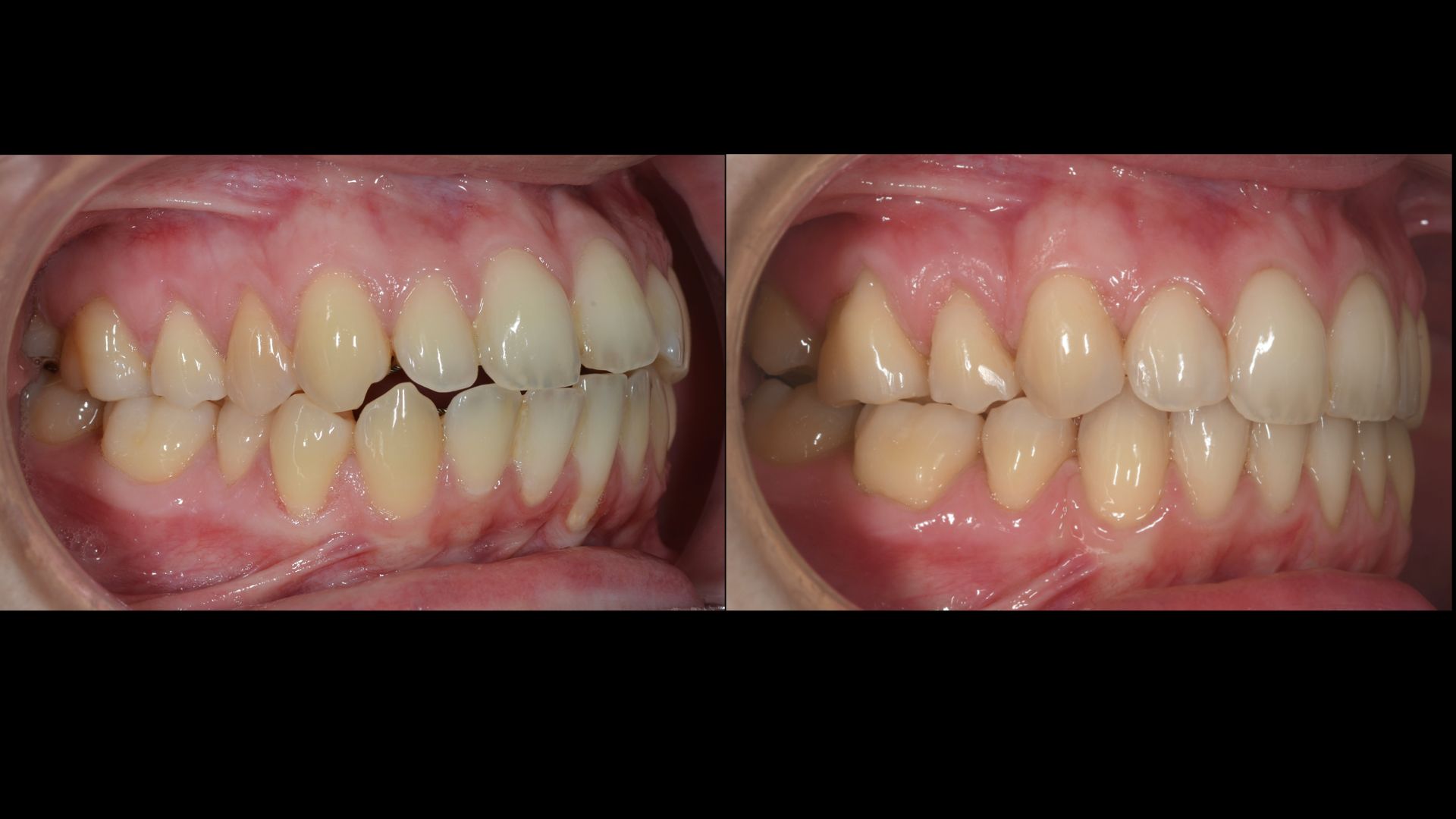 kyriaki ortho laspos (1)